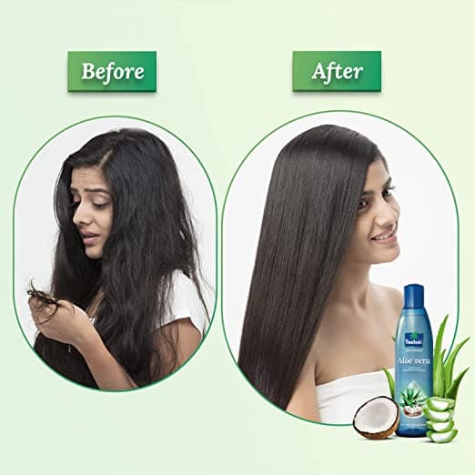 Buy The Parachute Advansed Aloe Vera And Coconut Hair Oil Now! Buy The Parachute Advansed Aloe Vera And Coconut Hair Oil Now!